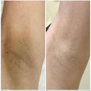 Amazolee - Creme Clareador de Manchas